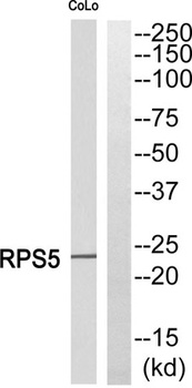 Ribosomal Protein S5 rabbit pAb