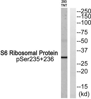 Ribosomal Protein S6 (phospho-Ser235/S236) antibody