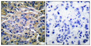 p70 S6 kinase α (phospho Thr421) rabbit pAb