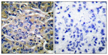 p70 S6 kinase alpha (phospho-Thr421) antibody