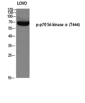 p70 S6 kinase alpha (phospho-Thr444) antibody
