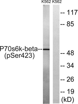 p70 S6 kinase β (phospho Ser423) rabbit pAb