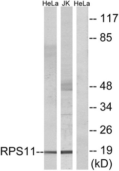 Ribosomal Protein S11 antibody