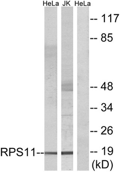 Ribosomal Protein S11 rabbit pAb