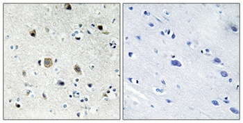 Ribosomal Protein S20 antibody