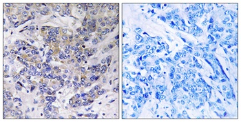 Ribosomal Protein S21 rabbit pAb