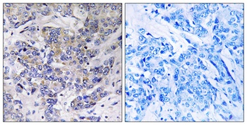 Ribosomal Protein S21 antibody