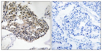 Ribosomal Protein S25 rabbit pAb