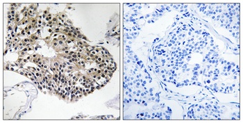 Ribosomal Protein S25 antibody