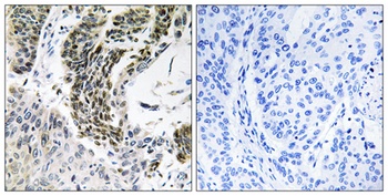 RREB1 antibody