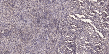 Rhotekin antibody