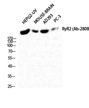 RyR-2 antibody