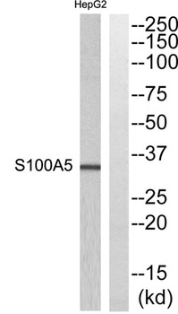 S-100A5 antibody