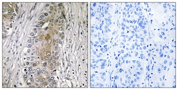 SAA4 antibody