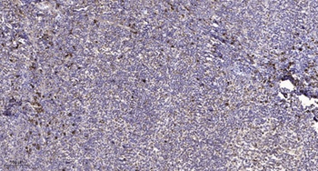 Na+ CP type IIα rabbit pAb