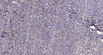 Na+ CP type II alpha antibody