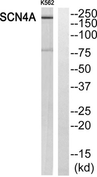 Na+ CP type IV alpha antibody