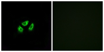Na+ CP type VIIα rabbit pAb