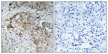 ENaC β (phospho Thr615) rabbit pAb