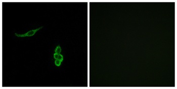 ENaC delta antibody