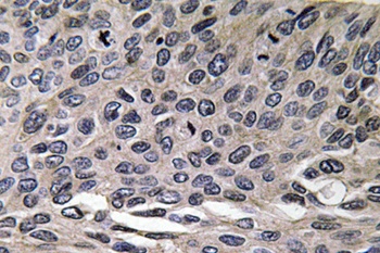 MIP-1α rabbit pAb