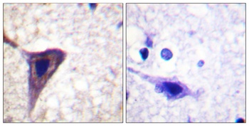 BID (phospho-Ser78) antibody