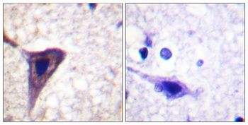 BID (phospho Ser78) rabbit pAb