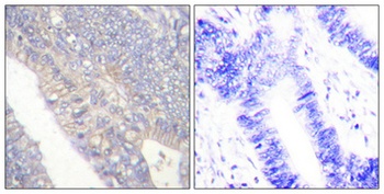 NBK (phospho Thr33) rabbit pAb
