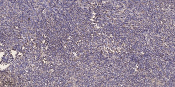 Serine racemase antibody