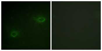 Syndecan-4 rabbit pAb Antibody
