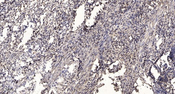 MRP-L17 rabbit pAb