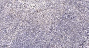 SH2D4A antibody