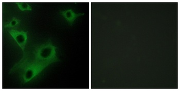 CIDE-3 antibody