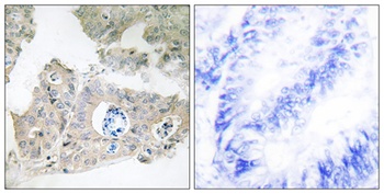 CIDE-3 rabbit pAb Antibody