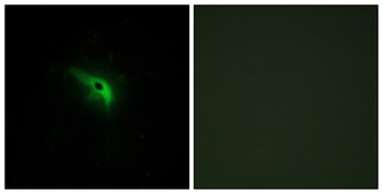 p53AIP1 antibody