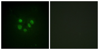 BLM antibody