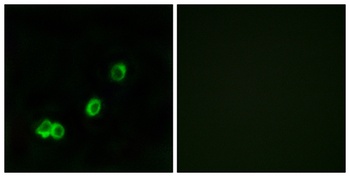 ACOT1 rabbit pAb Antibody