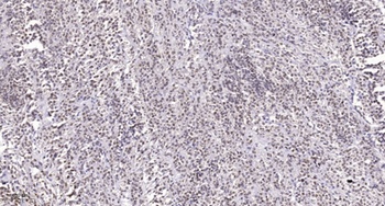 SRp55 antibody