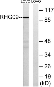 ARHGAP9 antibody