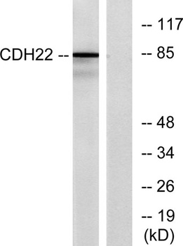 Cadherin-22 rabbit pAb Antibody
