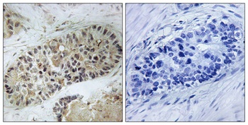 Artemis (phospho-Ser516) antibody