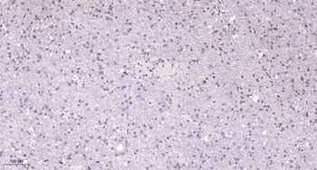 POLR1E rabbit pAb