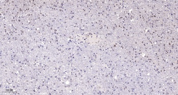 POLR1E antibody