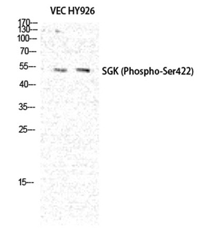 SGK1 (phospho Ser422) rabbit pAb