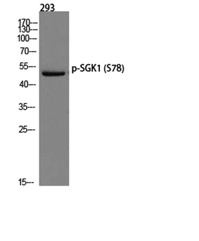 SGK1 (phospho Ser78) rabbit pAb