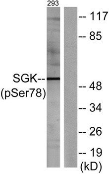 SGK1 (phospho Ser78) rabbit pAb Antibody