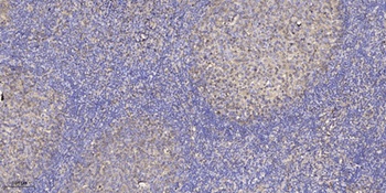 Shc (phospho-Ser36) antibody