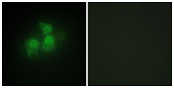 InsP5 2-kinase rabbit pAb