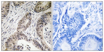 TUTase rabbit pAb