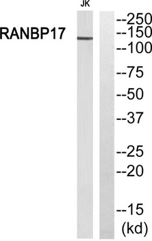 Ran BP-17 rabbit pAb Antibody